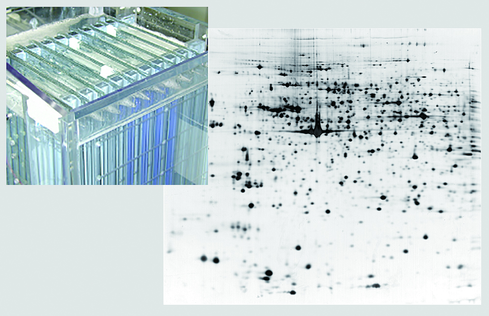 Two-dimensional electrophoretic protein image